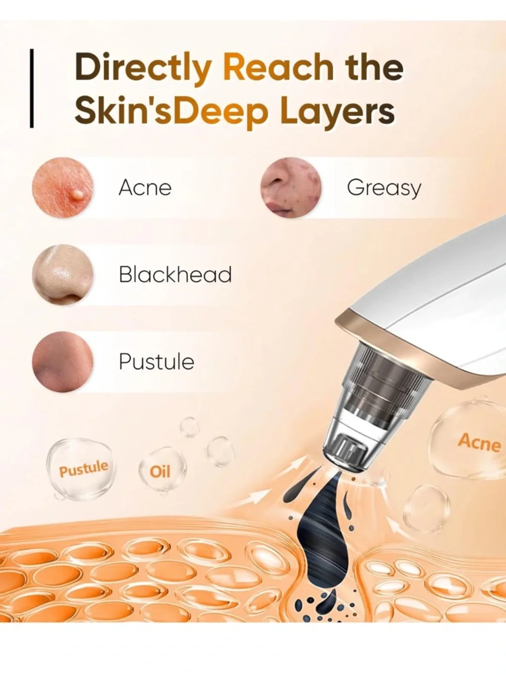 N/A upgraded blackhead